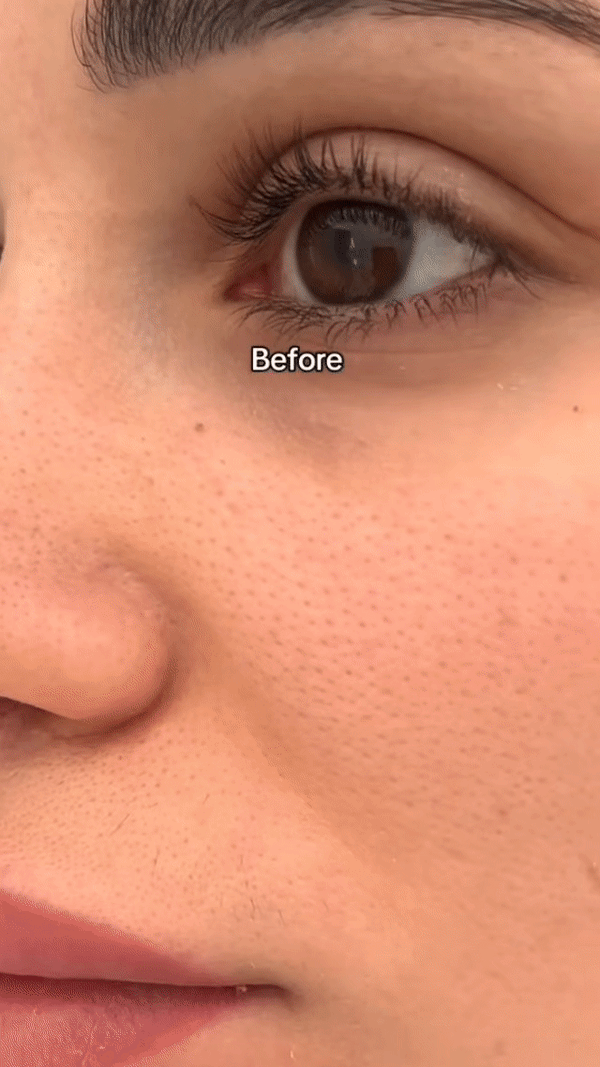 Smooth Skin Pore Essence